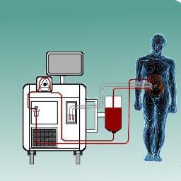 Hyperthermia Therapy (HIPEC) used in combination with surgery in the treatment of advanced abdominal cancers.