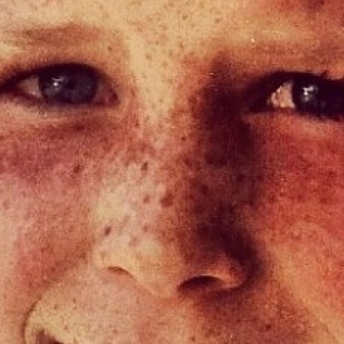 MadisonsFreckle's profile picture. The freckles on Madison's face, one of the top 20 Much Music VJ hopefuls! Inspired by @TierrasEyebrow #Madison4VJ #Madison4VJ #Madison4VJ