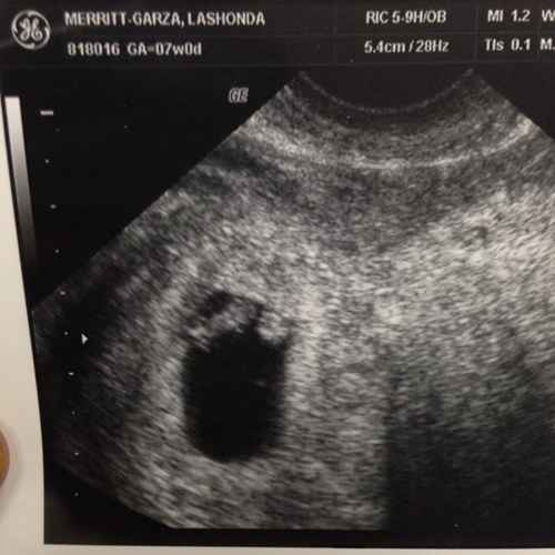 Capri_Garza's profile picture. Believe In Urself✊
Trust no bitch
have a attitude of a lion
I'm a Leo.