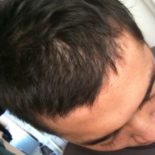 fsvonius's profile picture. やっとこ、慣れてきました。