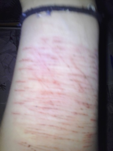 Slit your wrists and cut your thighs, fake a smile and dry your eyes, hate yourself and hate your life... WELCOME TO MY WORLD OF LIES...