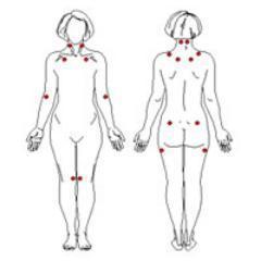 Somos uma Comissão de Portadores de Fibromialgia, na luta pelo reconhecimento dessa síndrome sem cura e invisível aos olhos de todos, menos em nossas vidas.