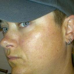 Storm Chaser, Photographer, CO, Severe Traumatic Brain Injury Survivor