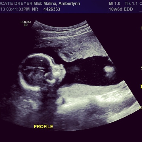 Eighteen. Taken. Proud Mommy To Be. 3