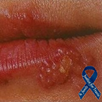 JodisColdSore's profile picture. 