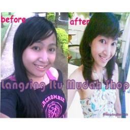 CepetLangsing's profile picture. Toko Pelangsing NO.1 dgn kualitas bintang 5. Turun 5kg seminggu itu sudah biasa. SMS/WHSP: 087776475552 , PIN:2750F0C6