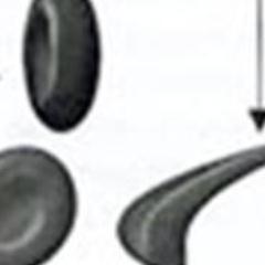 J'ai 19 ans J'ai la drépano je souhaiterais que des chaine de télé en parle parce que cette maladie n'est pas connue SVP AIDER NOUS , MERCI