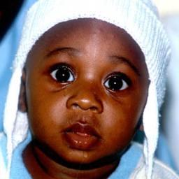 curemalaria's profile picture. We freely share knowledge and seeds of the proven plant cure. Sweet wormwood cured millions of people in China. Share the home grown cure to help end malaria.