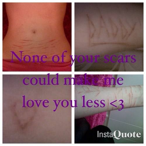 Forever wishing I was skinny and pretty.:( #Selfharm #ED 5ft4in HW:110 CW:96 LW:94 GW1:90 GW2:85 UGW:75