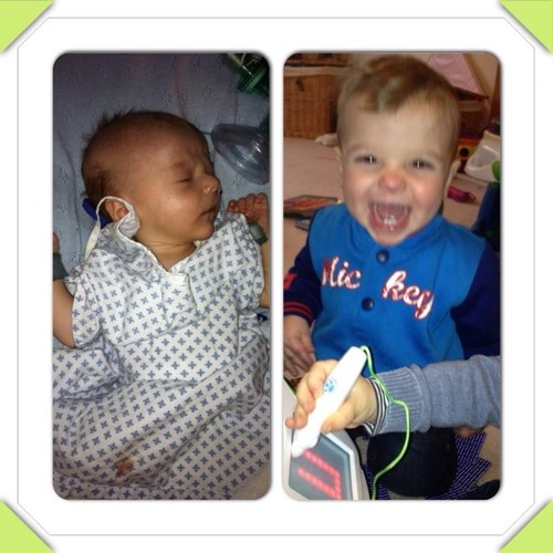 Our Ralph was born in Jan 2012 with gastroschisis so we've set up a Facebook page to support others affected. Join us now-
Gastroschisis family Support Group