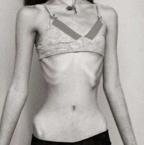 35 is the goal of my journey! Starving myself to death.
hw: 70 lw: 38