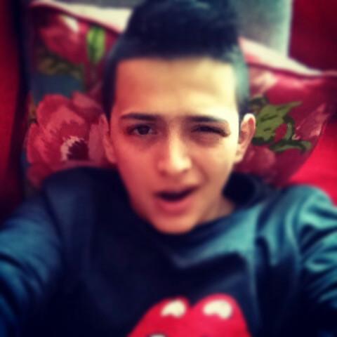Dr. Prof. Hasan fatih alpcan findik Dagdelen| Zuiderzee VKI3A | Naturel Kayserili | InstaFollow me ; @Reapix