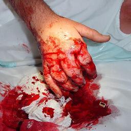 CraziestInjurie's profile picture. We show and upload the Craziest Injuries and Accidents around the world! We have over 200k fans on Facebook!