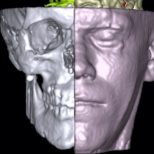 Principal Research Associate & Neurologist at the Functional Imaging Laboratory (UCL) working on computational anatomy, disease phenomics & multiscale methods.