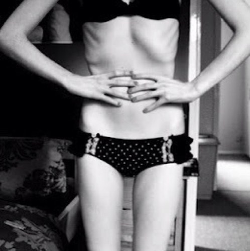 Anorexia Nervosa. 9 pounds from skinny. I will be skinny.