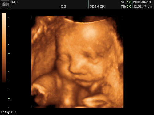 2D and Live 3D/4D Ultrasounds for parents to be!