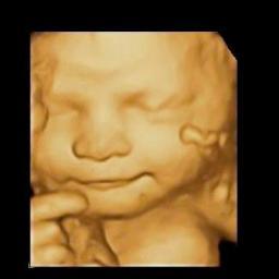PrenatalPicture's profile picture. Seeing your baby before it's born with the magic of 3d/4d ultrasound.