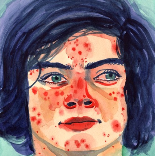 PimplesOfTheDay's profile picture. 