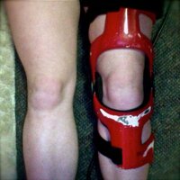 ACL Challenges (@acl_challenges) Twitter profile photo