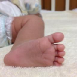 赤ちゃん 乳児脂漏性湿疹を真剣な顔でカリカリはがしてる うちのママは かさぶたとか日焼けの皮膚をひたすら剥くタイプだな