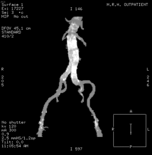 lessinvasive's profile picture. http://t.co/KIwu5HiSRd provides useful information& resources about minimally invasive procedures & surgeries.Lessinvasive..More informative...