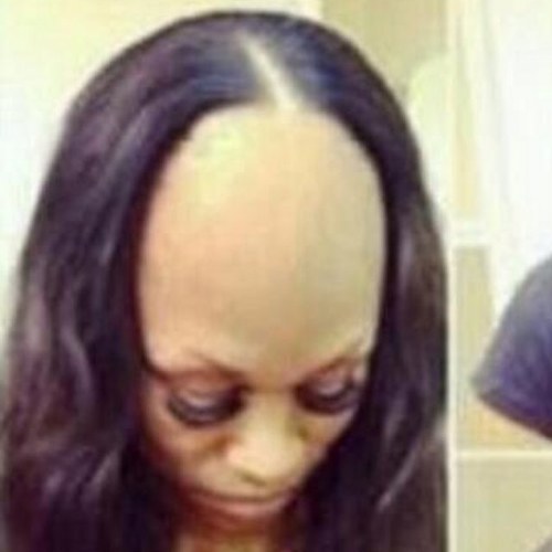 All about foreheads.