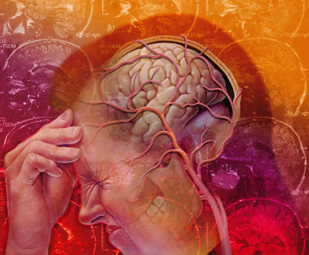 Migraine Headache Sufferer, #headache #migraine