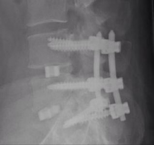 nicholas_murphy's profile picture. keen golfer, enjoys reading the twitter banter of the tour players, back playing golf again after spine surgery