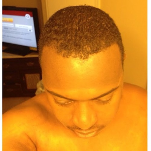 I shake my head at so much dumb stuff, I'm developing neck-ceps.