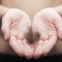 Alopecians United (@alopeciasupport) 's Twitter Profile