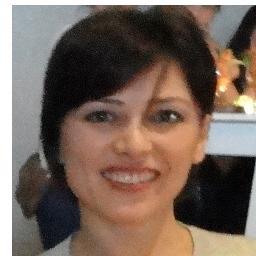 Oncology Nurse/University of Hacettepe