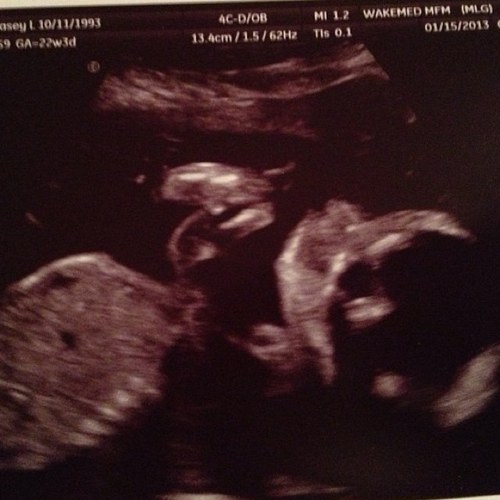 Chase Michael Ellis