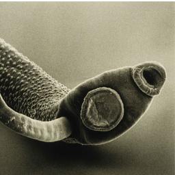 Everything you wanted to know (and maybe some things you'll wish you didn't) about the fascinating world of parasites!