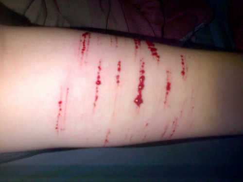 I'm 13years old. I have anorexia. I self harm. I'm going through depression. I'm allways just a DM away. I'll help you and give you my story. Bye♥