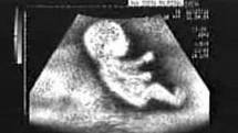 Futura hija de @EmmaSwanSb y @Graham_Cazador.Sere tan guapa y valiente como mis padres :)