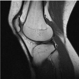 Medical Imaging Education #Imaging Referral and Interpretation. #IVCourses #MSKUltrasound. #IRMERCourses #radiographer #physio #osteopath #CT #MRI