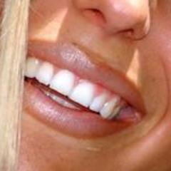 wellwhite78's profile picture. Professional laser teeth whitening services.