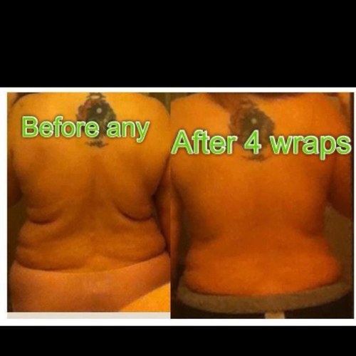 Have you heard of that crazy wrap thing? You can tighen, tone, & lose inches all in 45min! Not to mention it also helps with stretch marks and scars!