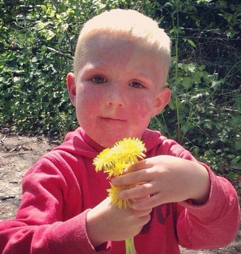 Every1is_unique's profile picture. Hi my son has inspired me to write a childrens book to educate about facial birthmark's and to raise more awareness and acceptance.