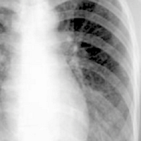 ChestRad (@chest_rad) 's Twitter Profile
