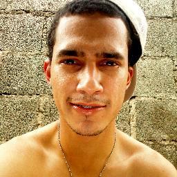 •••► Sua mãe passou tanto açucar em você que as formigas atacaram e deformaram seu rosto . ◄•••