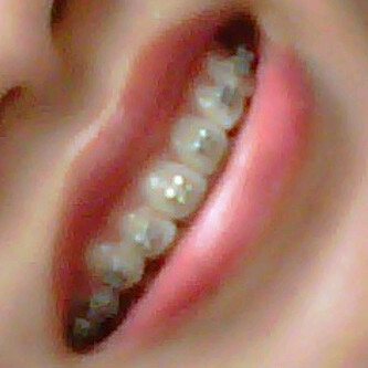 melayani: pasang BEHEL & GIGI palsu, pemutih gigi cp:081394445994/081703274406 pin:275fe7a1 bisa ϑĩ panggil.