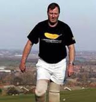 Double below knee amputee since 2006 due to meningicocal septicemea.