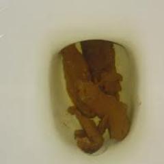 ieatpoopoo's profile picture. I draw celebrities and I eat poo... Now selling Poop on a stick and poop on a cone, fresh poop only sold here. any kind of poop we got it.