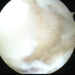 Traumatologo Ortopedista
Subespecialista en artroscopia e Implantes articulares. y fanatico numero 1 de los diablos rojos del Toluca