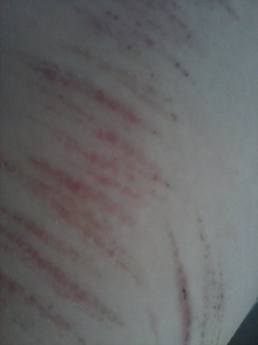 girl,14,suffer from major depression,have attempted suicide more than twice and I cut, clean for now