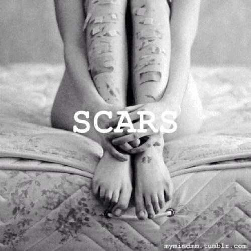 Diagnosed with Emotional Dysregulation Disorder 15/5/13. Skinny is the goal.