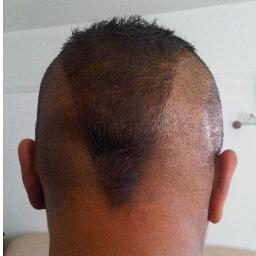 tango1967's profile picture. Here I can rant re cancer, diagnosed 02/2009, came back, remission 03/2011, tropical hardy gardener, afrobeats and God