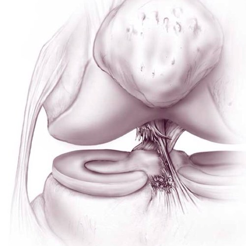 ACLthings's profile picture. #aclproblems