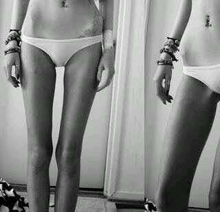 Bulimia y anorexia. Si no como no engordo,simple.